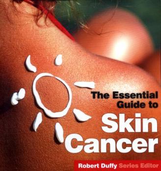 Paperback Skin Cancer: The Essential Guide Book