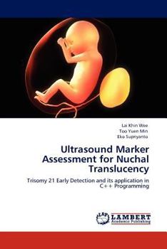 Paperback Ultrasound Marker Assessment for Nuchal Translucency Book
