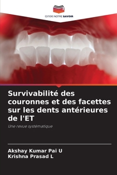 Paperback Survivabilité des couronnes et des facettes sur les dents antérieures de l'ET [French] Book