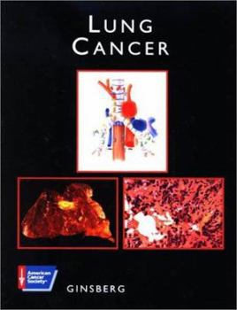 Hardcover American Cancer Society Atlas of Clinical Oncology: Lung Cancer (Book with CD-ROM) [With CDROM] Book
