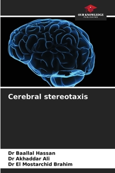 Paperback Cerebral stereotaxis Book