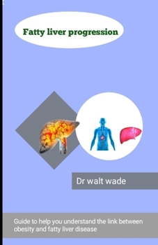 Fatty liver progression: Guide to help you understand the link between obesity and fatty liver disease