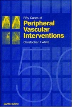 Hardcover Fifty Cases of Peripheral Vascular Interventions Book