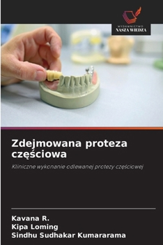 Zdejmowana proteza czesciowa (Polish Edition)