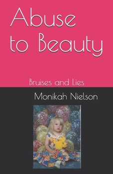 Paperback Abuse to Beauty: Bruises and Lies Book