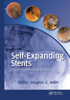 Hardcover Self-Expanding Stents in Gastrointestinal Endoscopy Book