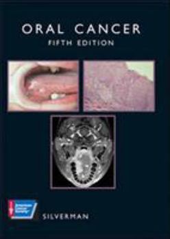Paperback Oral Cancer [With CDROM] Book
