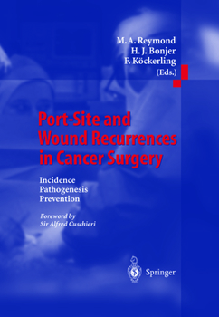 Paperback Port-Site and Wound Recurrences in Cancer Surgery: Incidence - Pathogenesis - Prevention Book