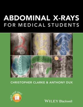 Paperback Abdominal X-Rays for Medical Students Book