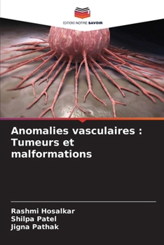 Paperback Anomalies vasculaires: Tumeurs et malformations [French] Book