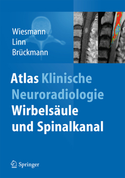 Hardcover Atlas Klinische Neuroradiologie: Wirbelsäule Und Spinalkanal [German] Book