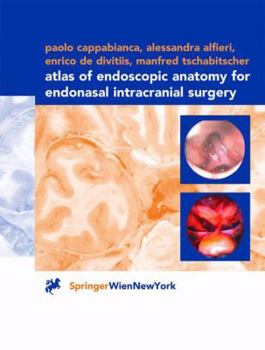 Paperback Atlas of Endoscopic Anatomy for Endonasal Intracranial Surgery Book