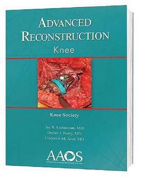 Hardcover Advanced Reconstruction: Knee Book