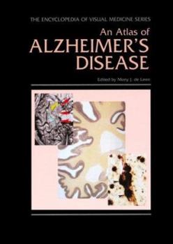 An Atlas of Alzheimer's Disease
