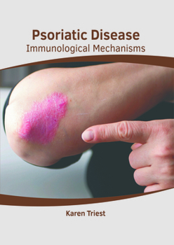 Psoriatic Disease: Immunological Mechanisms
