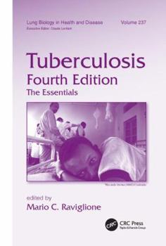 Paperback Tuberculosis: The Essentials, Fourth Edition Book