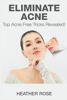Paperback Eliminate Acne: Top Acne Free Tricks Revealed! Book