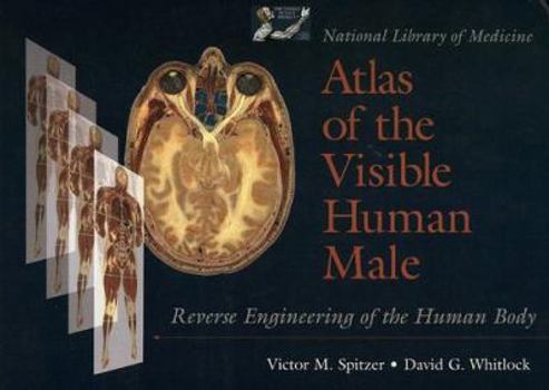 Hardcover National Library of Medicine Atlas of the Visible Human Male: Reverse Engineering of the Human Body: Reverse Engineering of the Human Body Book