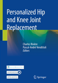 Paperback Personalized Hip and Knee Joint Replacement Book