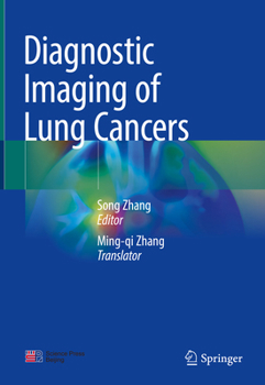 Hardcover Diagnostic Imaging of Lung Cancers Book