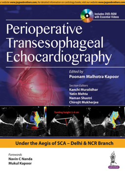 Hardcover Perioperative Transeasophageal Echocardiography Book