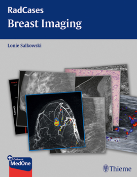 Paperback Radcases Breast Imaging Book
