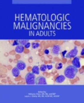 Paperback Hematologic Malignancies in Adults Book