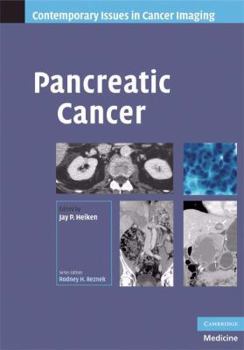 Hardcover Pancreatic Cancer Book