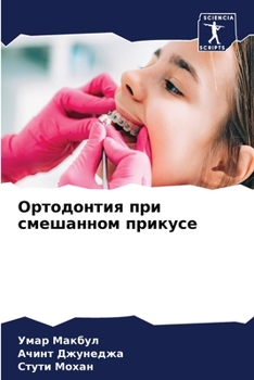 Ортодонтия при смешанно&