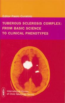 Hardcover Tuberous Sclerosis Complex: From Basic Science to Clinical Phenotypes Book