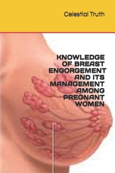 Paperback Knowledge of Breast Engorgement and Its Management Among Pregnant Women Book
