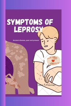 Paperback Symptoms of Leprosy: Ancient disease, past and present Book