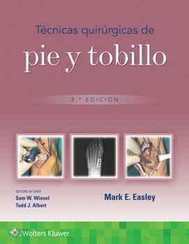 Paperback Técnicas Quirúrgicas de Pie Y Tobillo [Spanish] Book