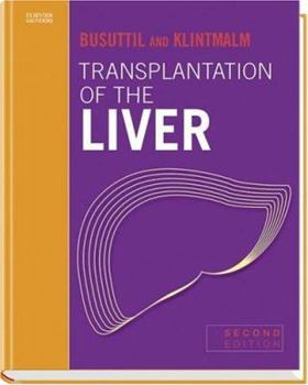 Hardcover Transplantation of the Liver Book