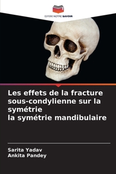 Paperback Les effets de la fracture sous-condylienne sur la symétrie la symétrie mandibulaire [French] Book