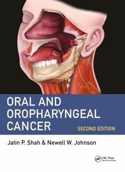 Paperback ORAL AND OROPHARYNGEAL CANCER 2ED (PB 2020) Book