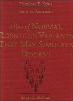 Hardcover Atlas of Normal Roentgen Variants That May Simulate Disease Book