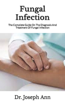Fungal Infection: The Complete Guide On The Diagnosis And Treatment Of Fungal Infection