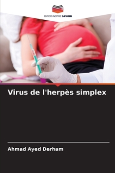 Paperback Virus de l'herpès simplex [French] Book