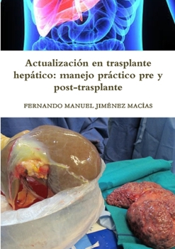 Paperback Actualización en trasplante hepático: manejo práctico pre y post-trasplante [Spanish] Book