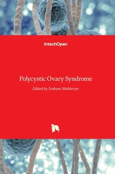 Hardcover Polycystic Ovary Syndrome Book