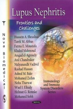 Paperback Lupus Nephritis: Frontiers and Challenges Book
