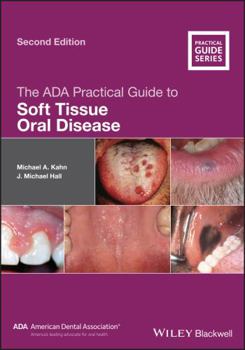 Paperback The ADA Practical Guide to Soft Tissue Oral Disease Book