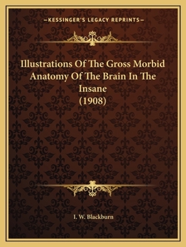 Illustrations Of The Gross Morbid Anatomy Of The Brain In The Insane