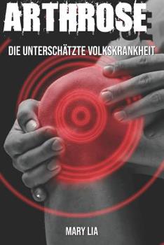 Paperback Arthrose: Die unterschätzte Volkskrankheit [German] Book