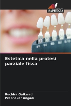 Estetica nella protesi parziale fissa (Italian Edition)