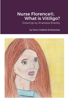 Paperback Nurse Florence(R), What is Vitiligo? Book