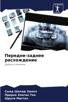 Paperback Передне-заднее расхожде& [Russian] Book