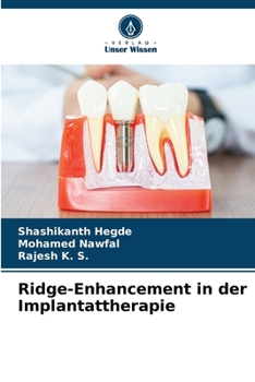 Paperback Ridge-Enhancement in der Implantattherapie [German] Book