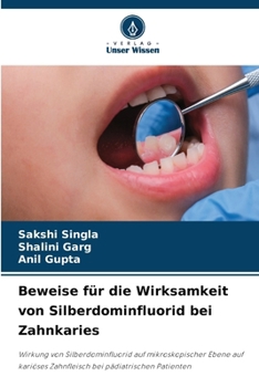 Paperback Beweise für die Wirksamkeit von Silberdominfluorid bei Zahnkaries [German] Book